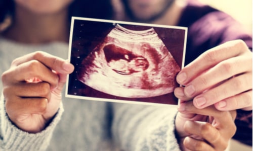 Couple holding ultrasound picture